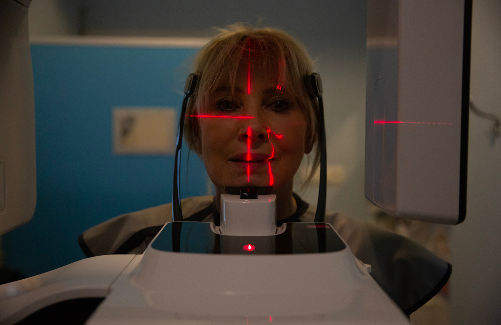 Tomografia stożkowa (CBCT) dentysta Anna Kot Tomografia stożkowa (CBCT) dentysta Anna Kot